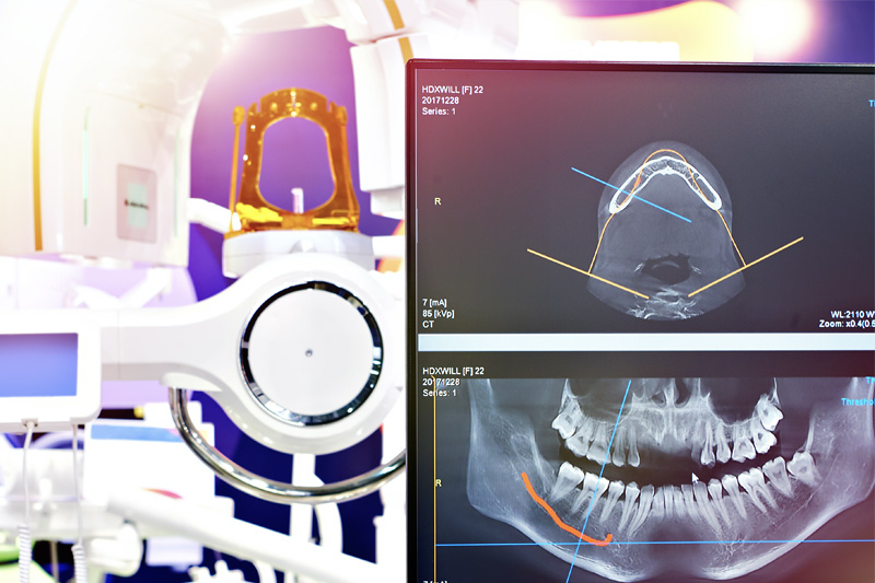 3D X-rays in Dublin