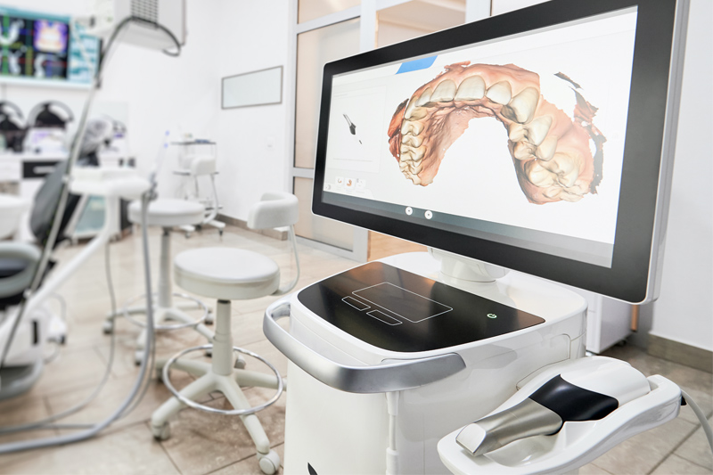Intra-Oral Scanner in Dublin
